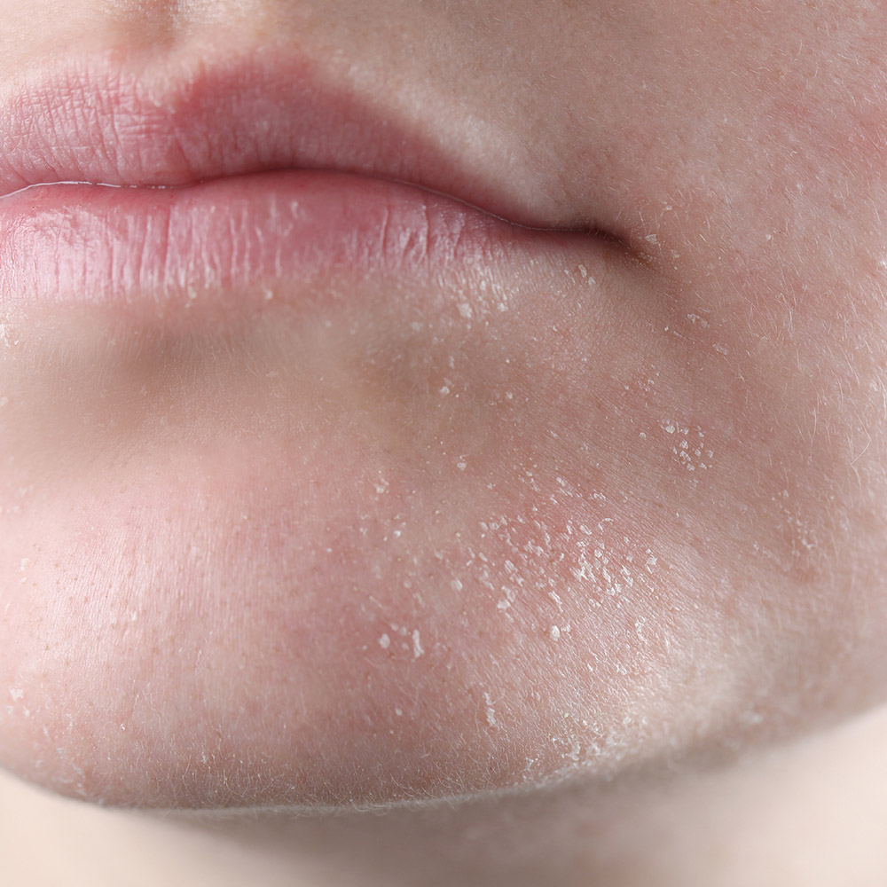 Artikel Billeder 1000X1000px 11 NY