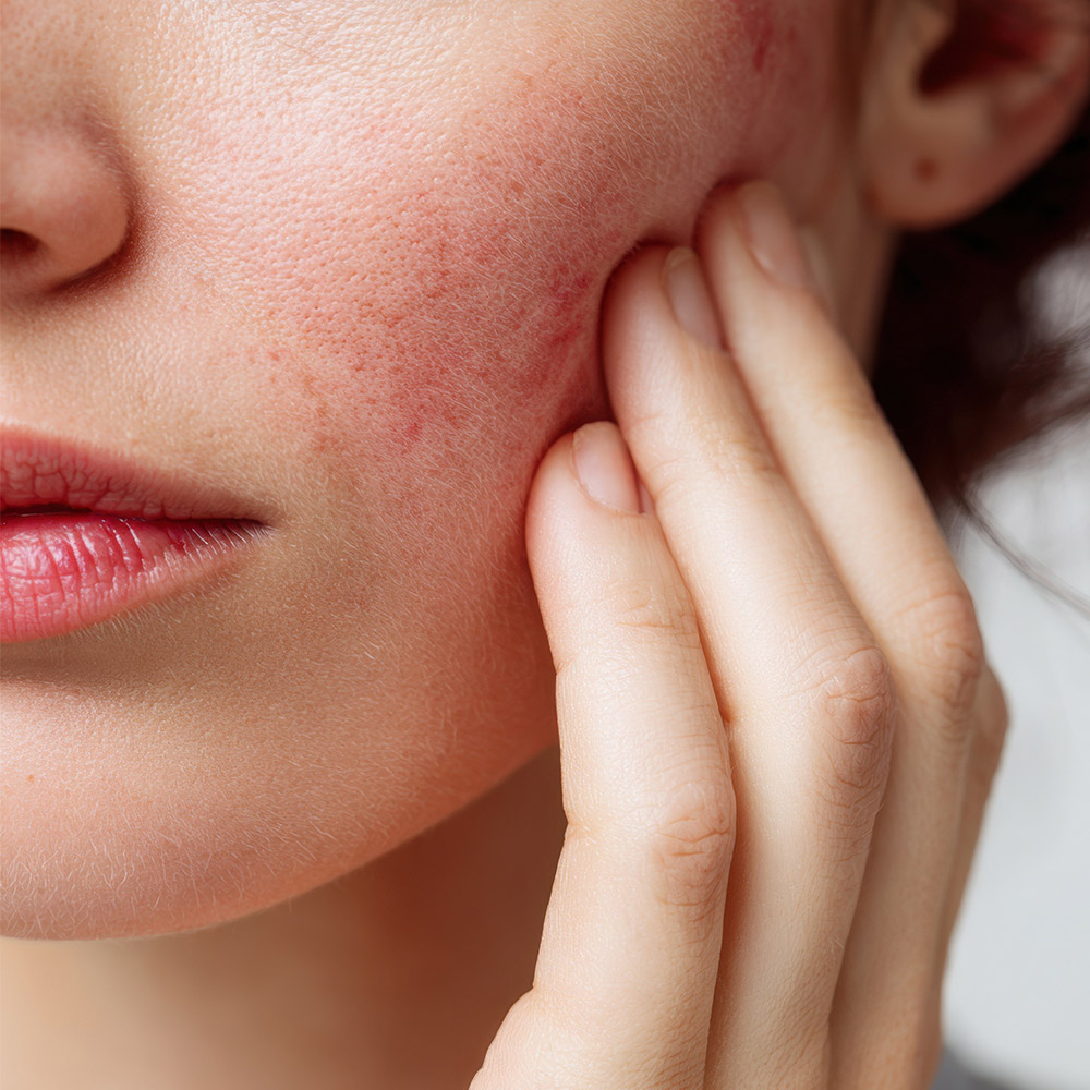 Artikel Billeder 1000X1000px 23 NY