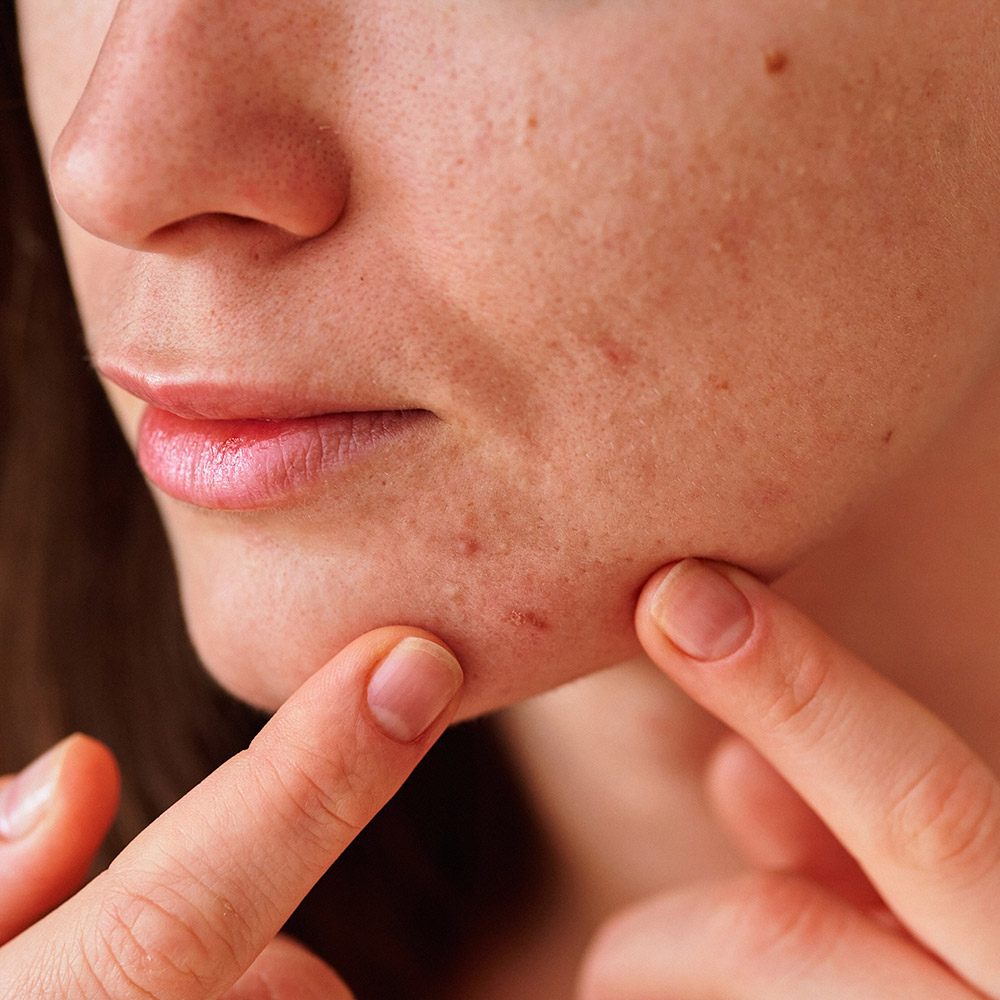 Artikel Billeder 1000X1000px 13 NY