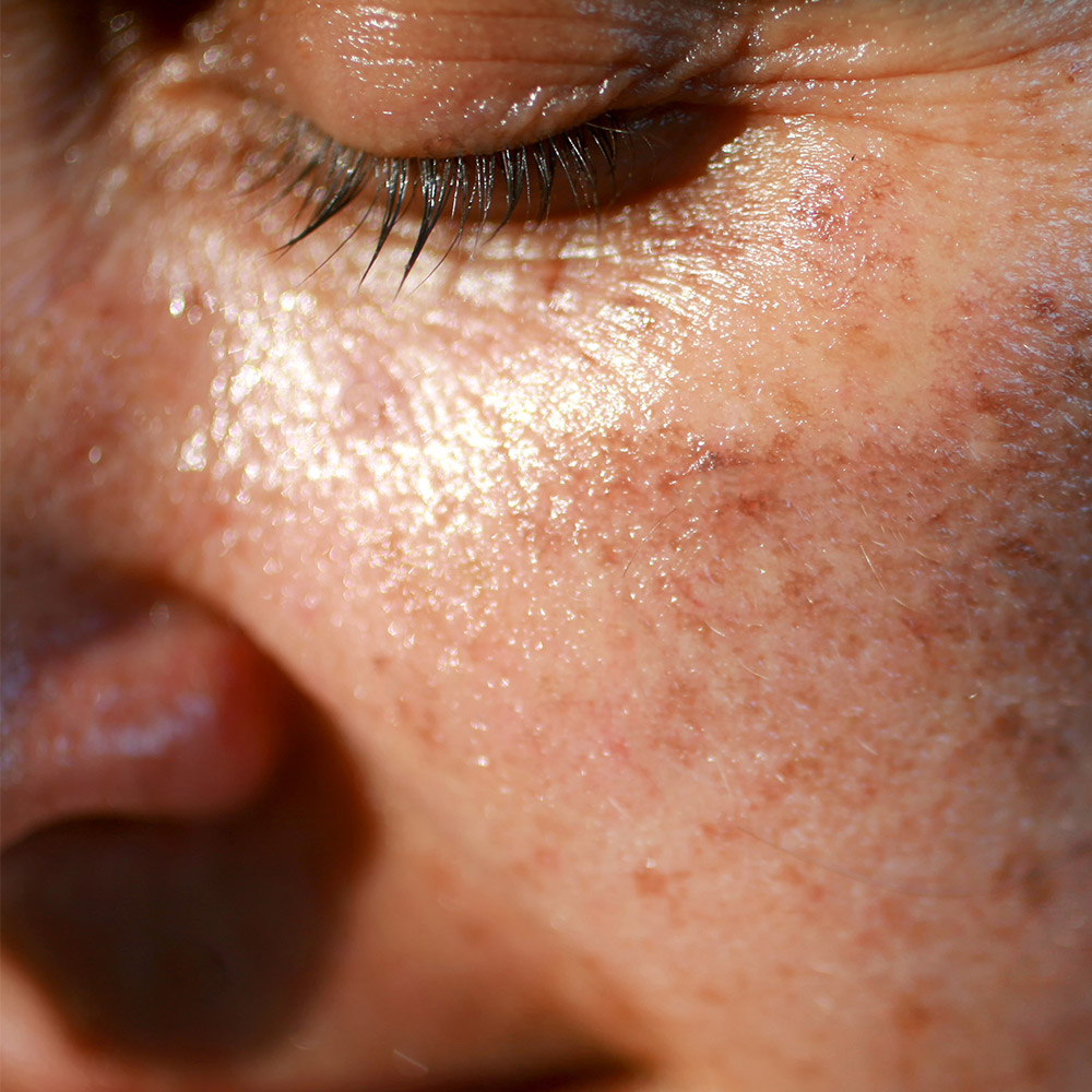 Artikel Billeder 1000X1000px 3 NY